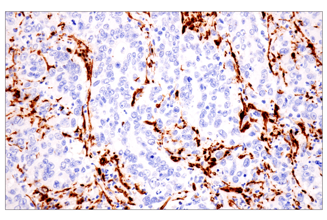 Immunohistochemistry Image 6: Transgelin/TAGLN (F3B7H) Rabbit Monoclonal Antibody
