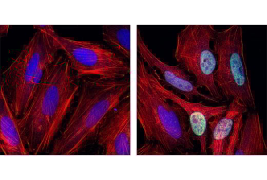Immunofluorescence Image 1: p57 Kip2 Antibody