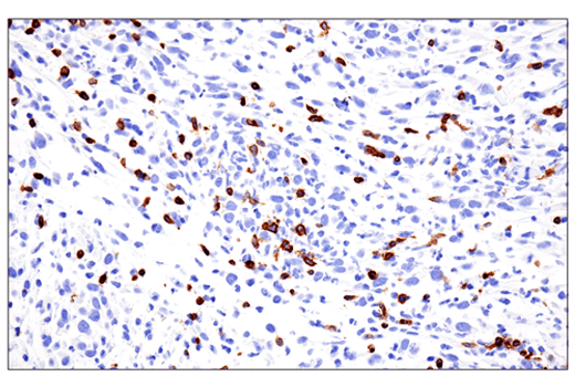 Immunohistochemistry Image 3: CD3 epsilon (E4T1B) Rabbit Monoclonal Antibody