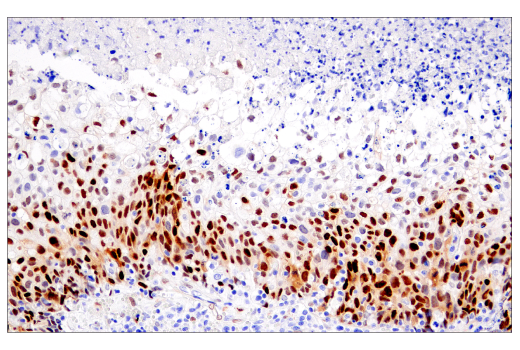 Immunohistochemistry Image 2: Cyclin D1 (E3P5S) Rabbit Monoclonal Antibody (BSA and Azide Free)