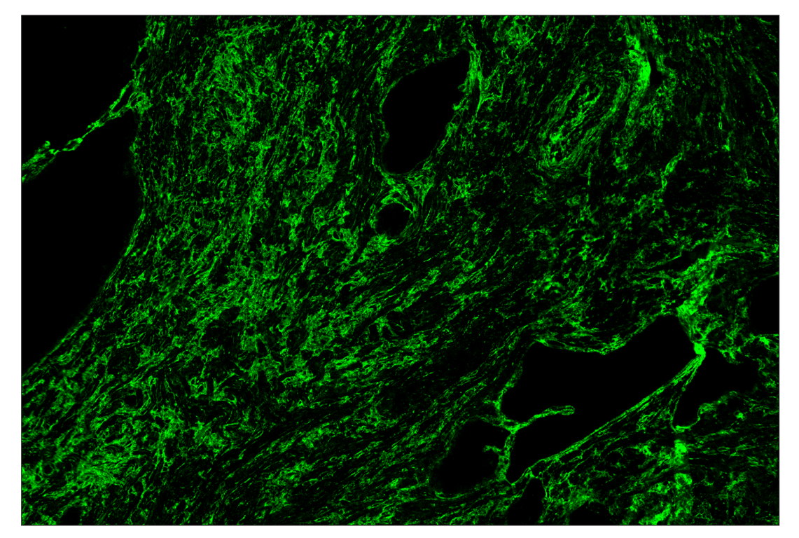 Immunohistochemistry Image 2: COL1A1 (E8F4L) & CO-0106-488 SignalStar<sup>™</sup> Oligo-Antibody Pair