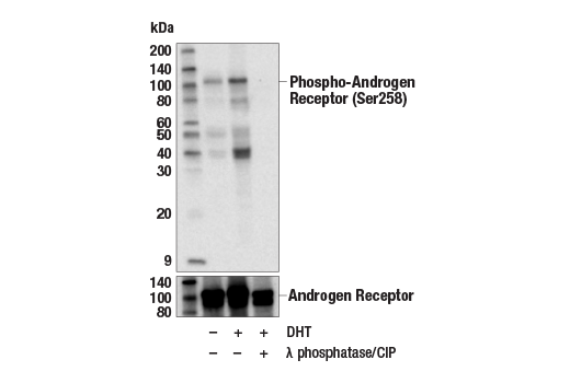 undefined Image 1: PhosphoPlus<sup>®</sup> Androgen Receptor (Ser258) Antibody Duet