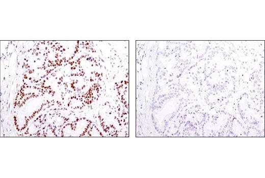 undefined Image 27: Acetyl-Histone Antibody Sampler Kit