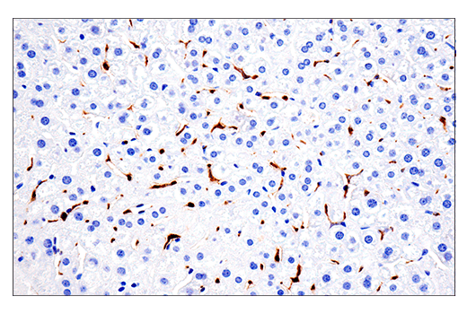 Immunohistochemistry Image 4: CD68 (E3O7V) Rabbit Monoclonal Antibody