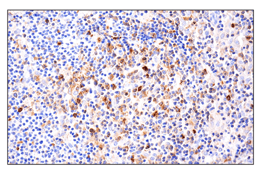 Immunohistochemistry Image 6: Phospho-SLP-76 (Ser376) (E3G9U) Rabbit Monoclonal Antibody (BSA and Azide Free)