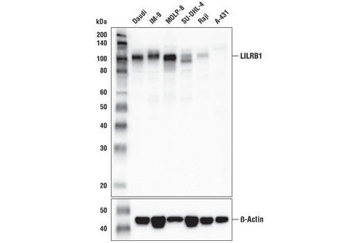 Western Blotting Image 2: LILRB1/CD85j (D4L8L) Rabbit Monoclonal Antibody