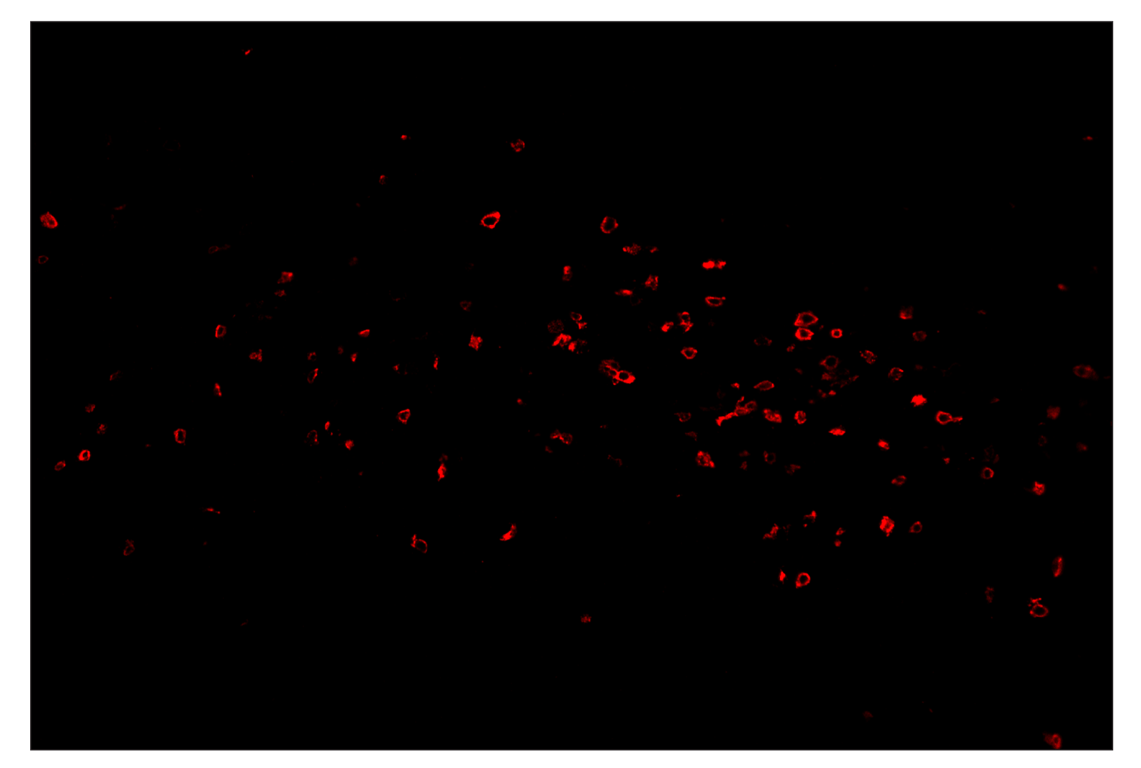 Immunohistochemistry Image 4: CD8α (D4W2Z) & CO-0040-647 SignalStar<sup>™</sup> Oligo-Antibody Pair