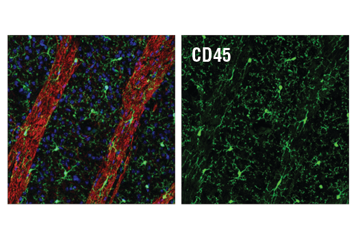 CD45 (D3F8Q) Rabbit mAb | Cell Signaling Technology