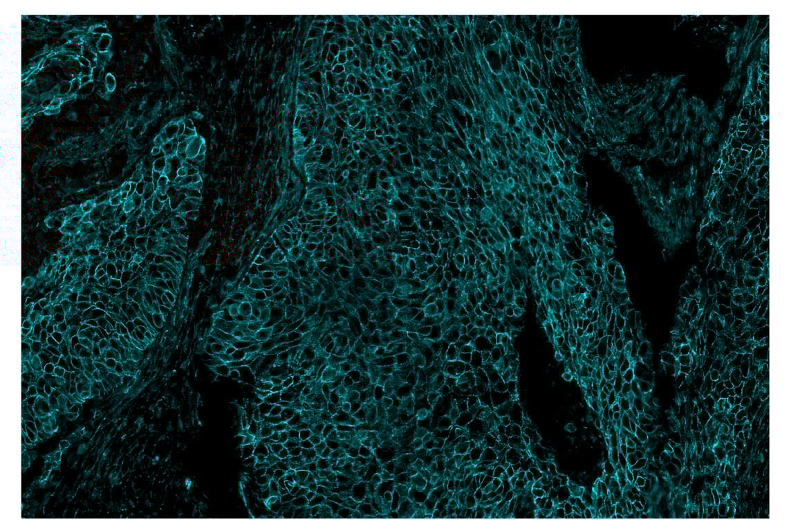 Immunohistochemistry Image 4: beta-Catenin (D10A8) & CO-0108-750 SignalStar<sup>™</sup> Oligo-Antibody Pair