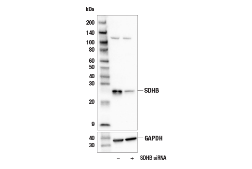 Western Blotting Image 2: SDHB (E3H9Z) Rabbit Monoclonal Antibody