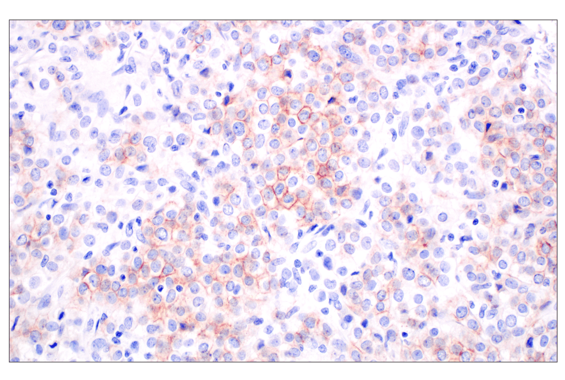 Immunohistochemistry Image 2: GFR alpha1 (F7R3F) Rabbit Monoclonal Antibody