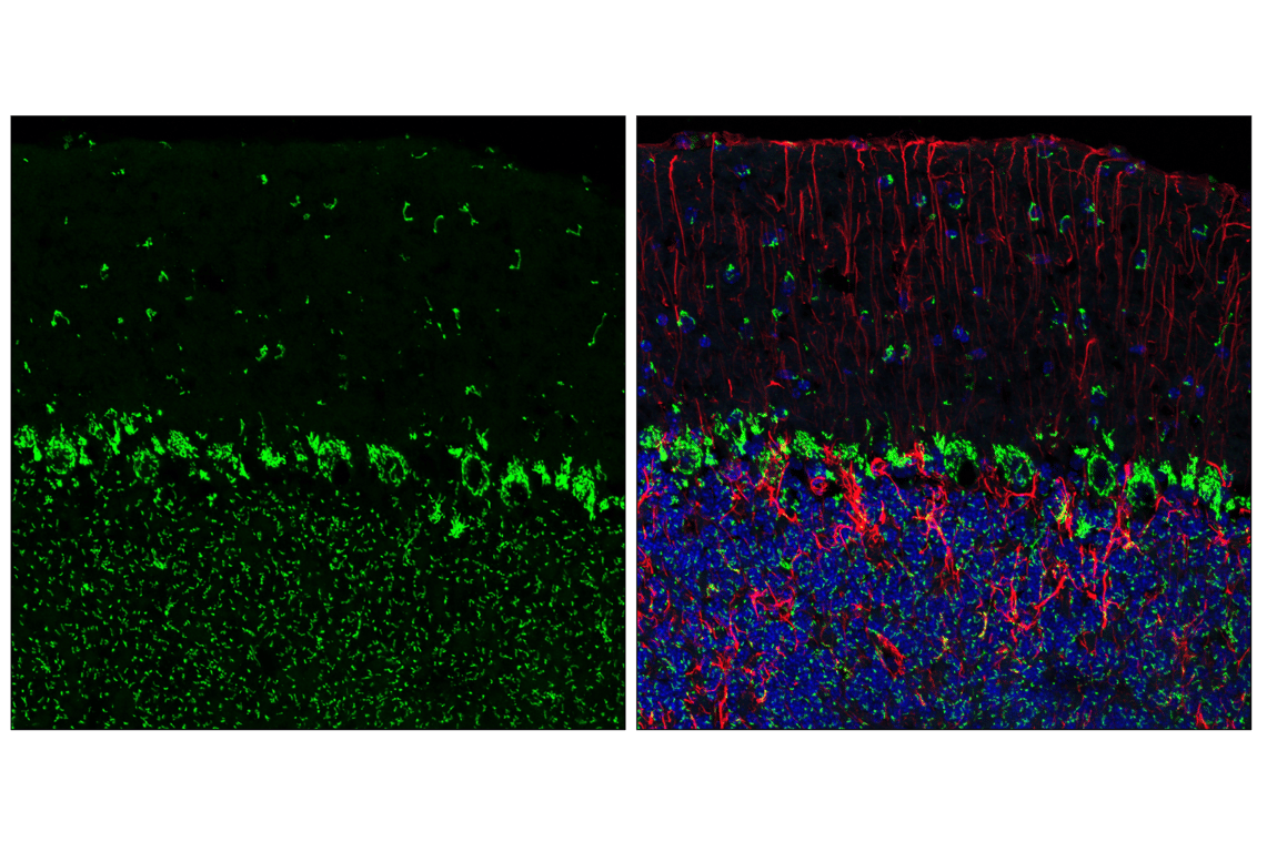 Immunofluorescence Image 1: GM130 (E9Z6S) Rabbit Monoclonal Antibody
