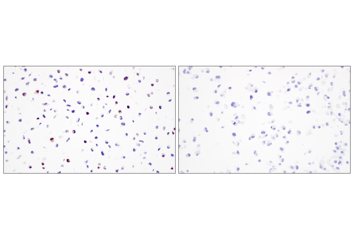 Immunohistochemistry Image 5: Myogenin (E9A1S) Rabbit Monoclonal Antibody