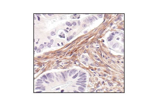 undefined Image 12: Angiogenesis Receptor Tyrosine Kinase Antibody Sampler Kit