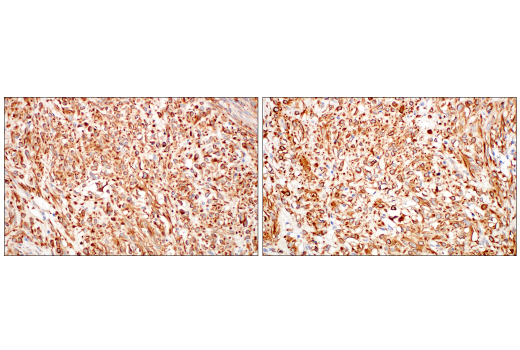 Immunohistochemistry Image 7: Nestin (10C2) Mouse Monoclonal Antibody