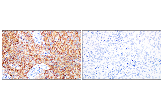 Immunohistochemistry Image 8: Glut1 (E4S6I) Rabbit Monoclonal Antibody