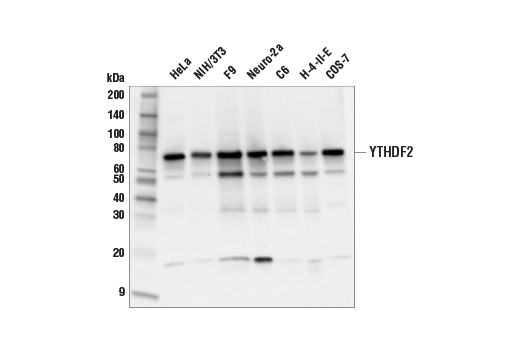 undefined Image 22: N6-Methyladenosine (m6A) Binding Protein Antibody Sampler Kit