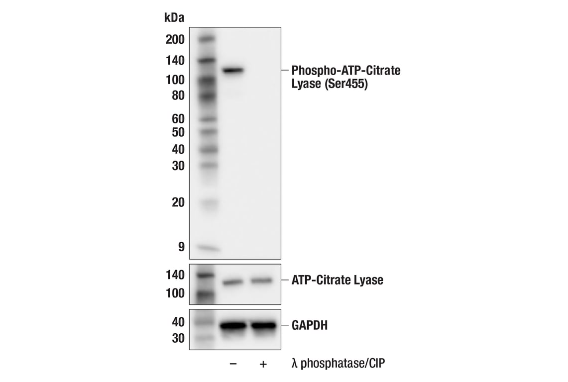 Western Blotting Image 2: Phospho-ATP-Citrate Lyase (Ser455) (F4T8R) Rabbit Monoclonal Antibody