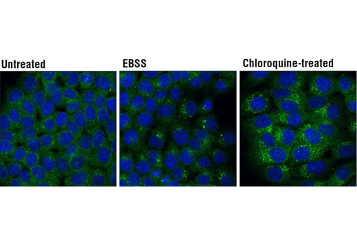 Immunofluorescence Image 1: Atg5 (D6M7Q) Rabbit mAb