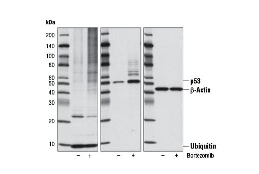 undefined Image 2: Bortezomib