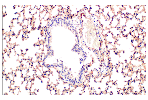 Immunohistochemistry Image 5: Phospho-CrkL (Tyr207) (E9A1U) Rabbit Monoclonal Antibody (BSA and Azide Free)