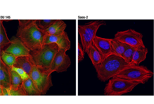 undefined Image 16: p62/KEAP1/NRF2 Pathway Antibody Sampler Kit