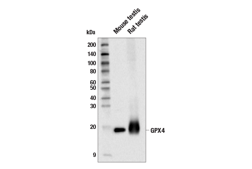 Glutathione Peroxidase 4 Antibody (E5Y8K) Rabbit mAb | Cell