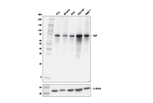 undefined Image 12: Apoptosis/Necroptosis Antibody Sampler Kit II