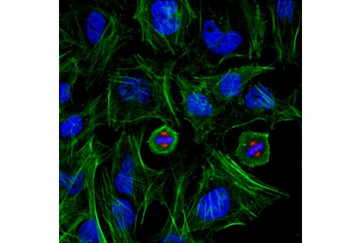 Immunofluorescence Image 1: Phospho-Aurora A (Thr288)/Aurora B (Thr232)/Aurora C (Thr198) (D13A11) XP<sup>®</sup> Rabbit mAb  (Alexa Fluor<sup>®</sup> 555 Conjugate)