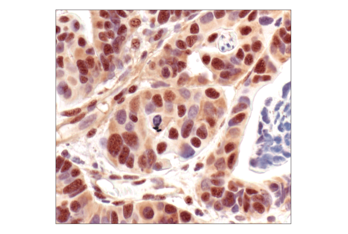 Immunohistochemistry Image 2: Phospho-Akt Substrate (RXXS*/T*) (110B7E) Rabbit Monoclonal Antibody