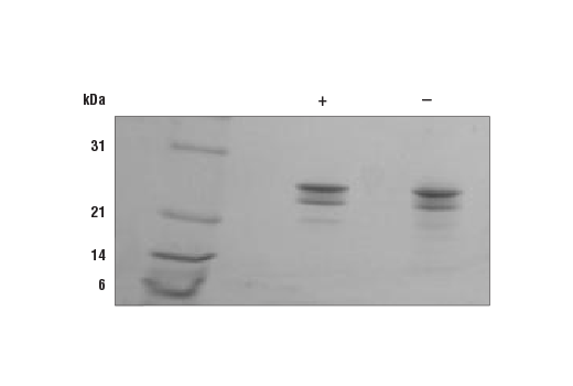 undefined Image 1: Mouse FGF-9 Recombinant Protein