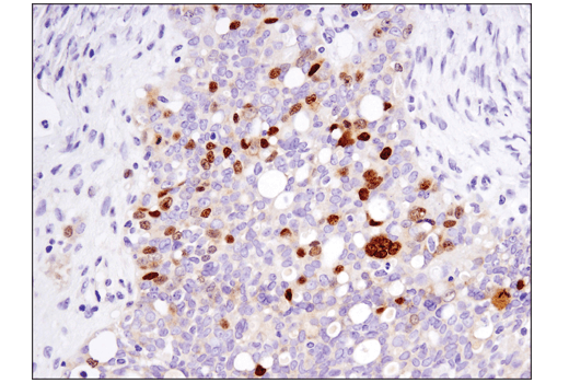 Immunohistochemistry Image 2: FoxM1 (D3F2B) Rabbit Monoclonal Antibody