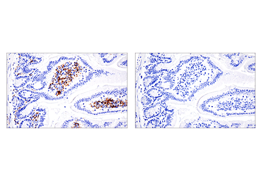 Immunohistochemistry Image 7: CD68 (E3O7V) Rabbit mAb