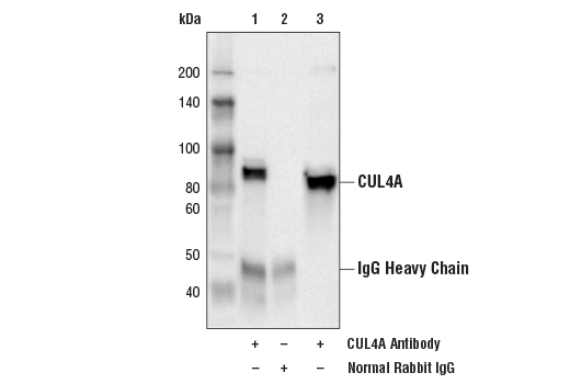 undefined Image 10: CRL4/CRBN Targeted Protein Degradation Complex Antibody Sampler Kit