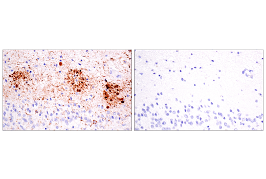 Immunohistochemistry Image 6: Phospho-Tau (Thr205) (E3E3B) Mouse Monoclonal Antibody