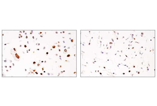 Immunohistochemistry Image 5: ATAD2 (E8Y2K) Rabbit Monoclonal Antibody