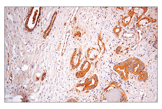 Immunohistochemistry Image 4: Rab5A (E6N8S) Mouse Monoclonal Antibody (BSA and Azide Free)