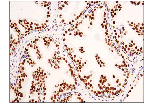 Immunohistochemistry Image 3: Asymmetric Dimethyl-SMARCC1/BAF155 (Arg1064) (D8I3U) Rabbit Monoclonal Antibody