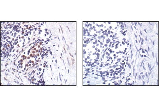 Immunohistochemistry Image 1: Phospho-TLK1 (Ser743) Antibody