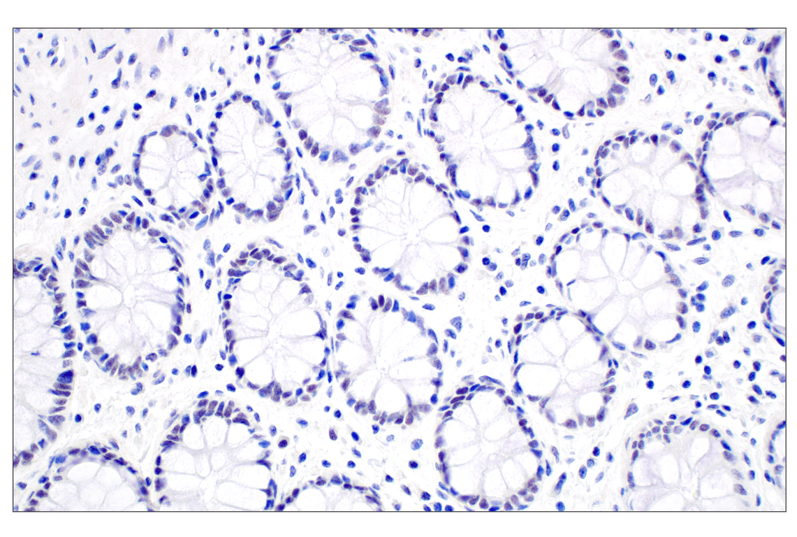 Immunohistochemistry Image 6: MDM2 (F7W7X) Rabbit Monoclonal Antibody