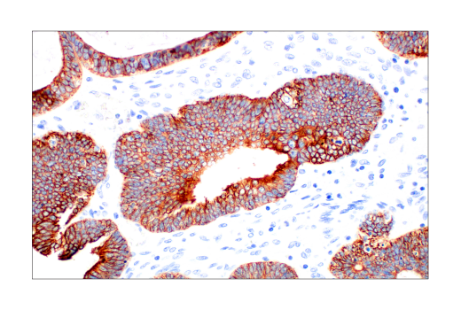 Immunohistochemistry Image 5: Pan-Keratin (AE1/AE3) Mouse Monoclonal Antibody