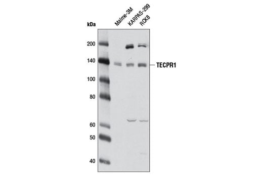 Western Blotting Image 2: TECPR1 (D6C10) Rabbit Monoclonal Antibody