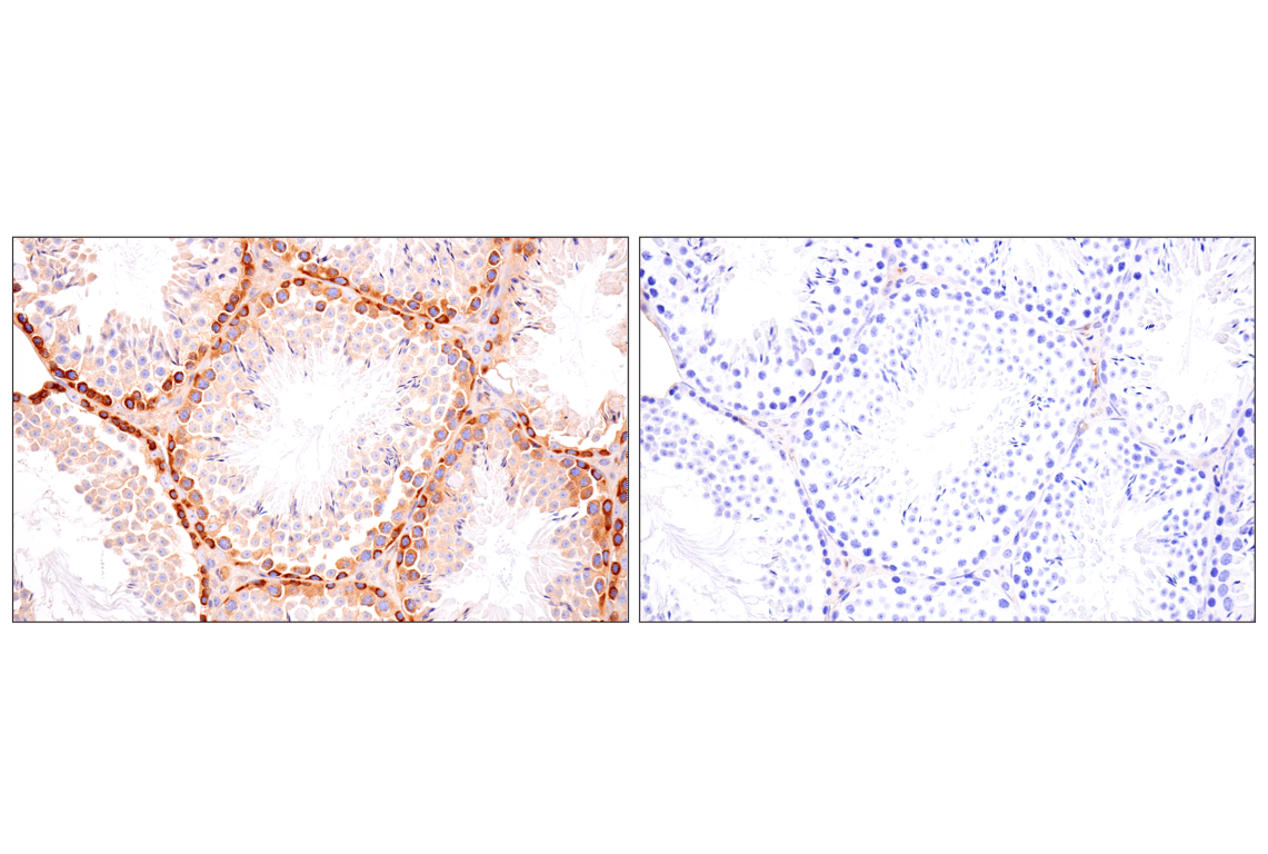 Immunohistochemistry Image 8: FAK (F7Z4C) Mouse Monoclonal Antibody (BSA and Azide Free)