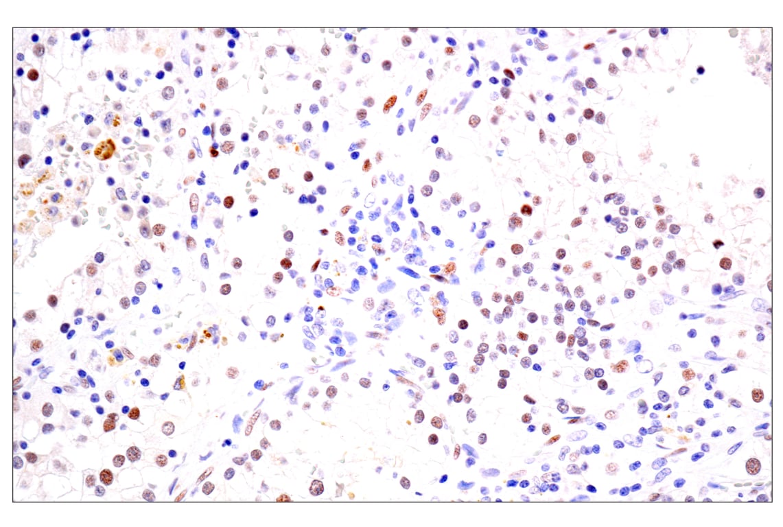 Immunohistochemistry Image 2: BATF3 (E3F3L) Rabbit Monoclonal Antibody (BSA and Azide Free)