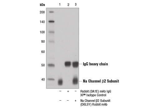 Immunoprecipitation Image 1: Na Channel beta2 Subunit (D6L5Y) Rabbit Monoclonal Antibody