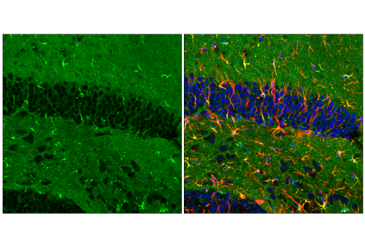 Immunofluorescence Image 4: ApoE (E7X2A) Rabbit Monoclonal Antibody