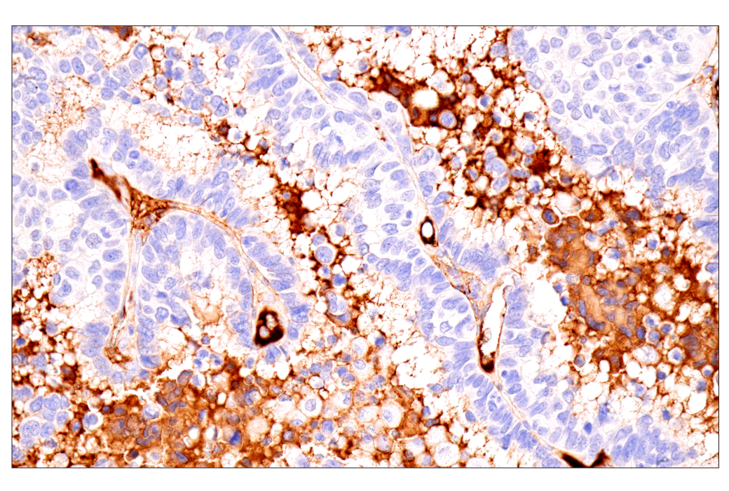 Immunohistochemistry Image 1: IgM (E9U8J) XP<sup>®</sup> Rabbit mAb