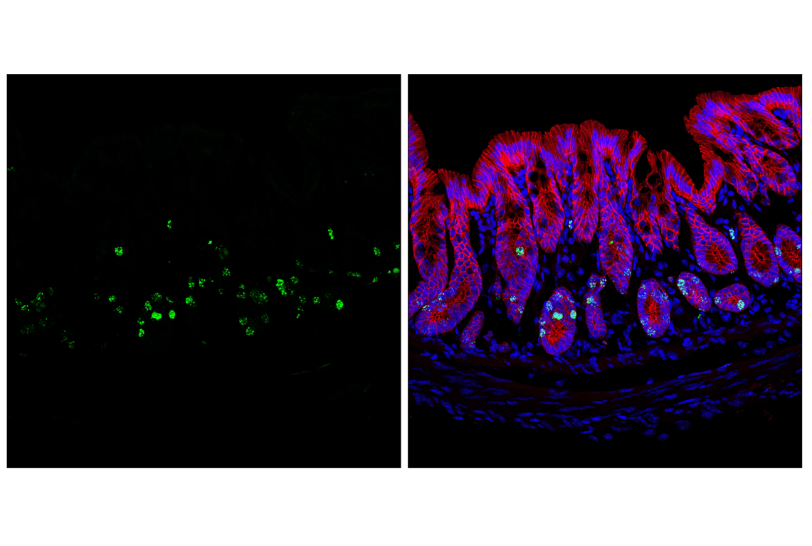 Immunofluorescence Image 1: Phospho-Histone H3 (Ser10) (D7N8E) Rabbit Monoclonal Antibody