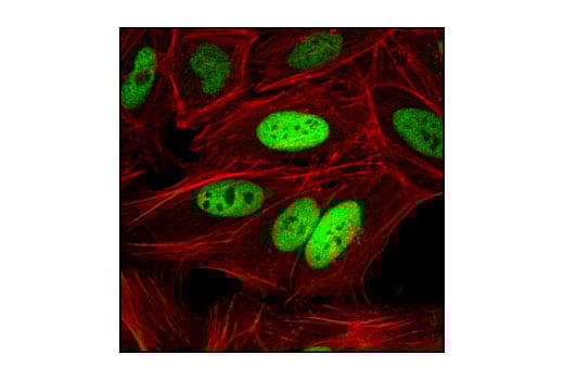 Immunofluorescence Image 1: c-Jun (60A8) Rabbit Monoclonal Antibody (BSA and Azide Free)