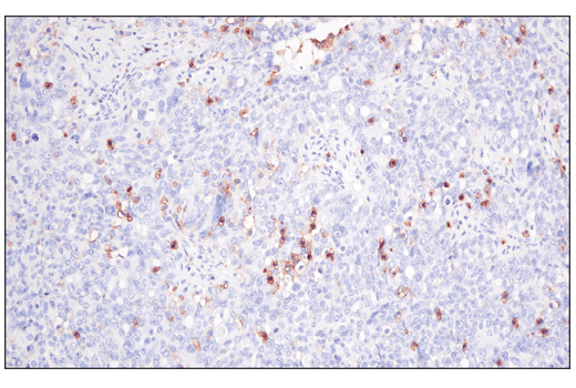 Immunohistochemistry Image 5: CD48 (D7L8I) Rabbit Monoclonal Antibody